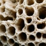 Osteoporosis