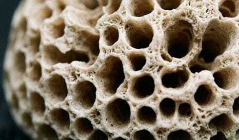 Osteoporosis